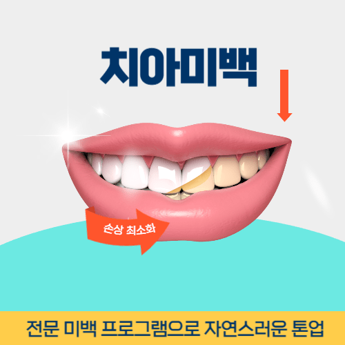 당진치과 당진시 치과 치아미백