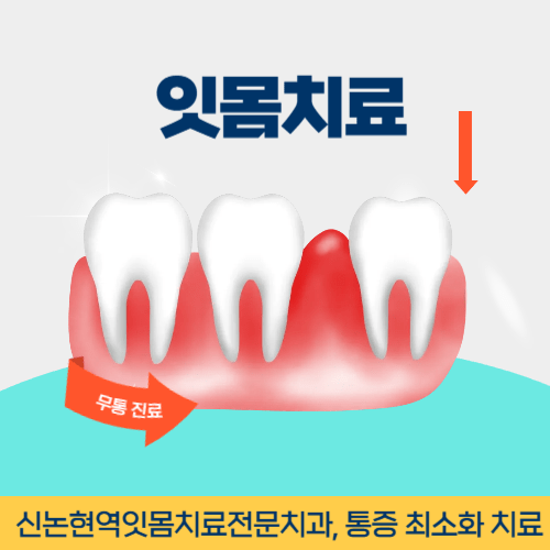 당진치과 당진시 치과 잇몸치료